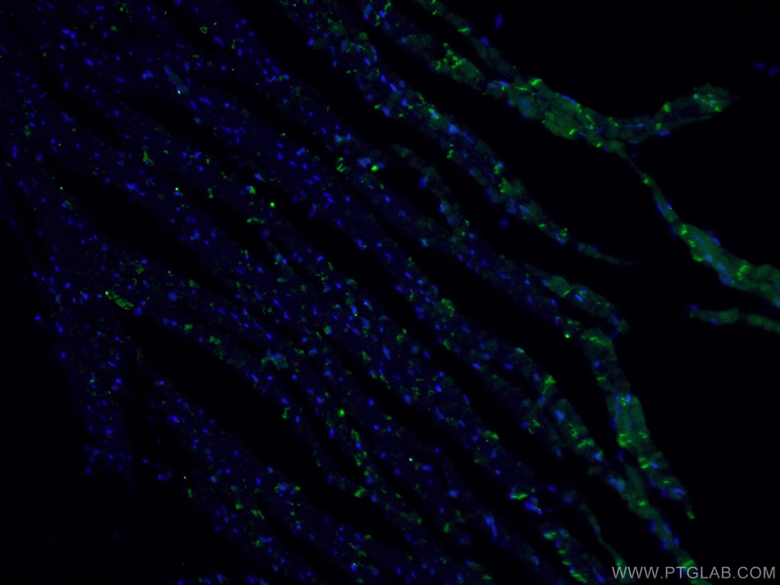 Immunofluorescence (IF) / fluorescent staining of mouse heart tissue using Desmocollin 2 Polyclonal antibody (13876-1-AP)