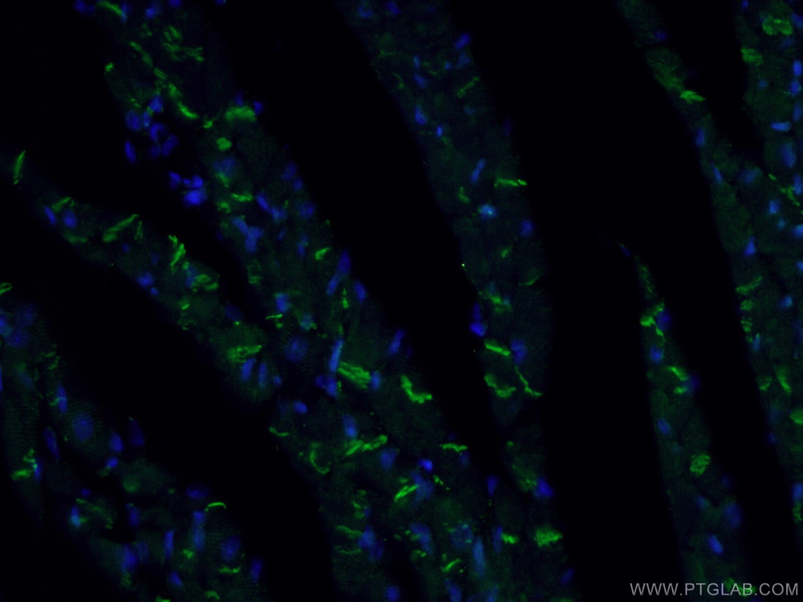 Immunofluorescence (IF) / fluorescent staining of mouse heart tissue using Desmocollin 2 Polyclonal antibody (13876-1-AP)
