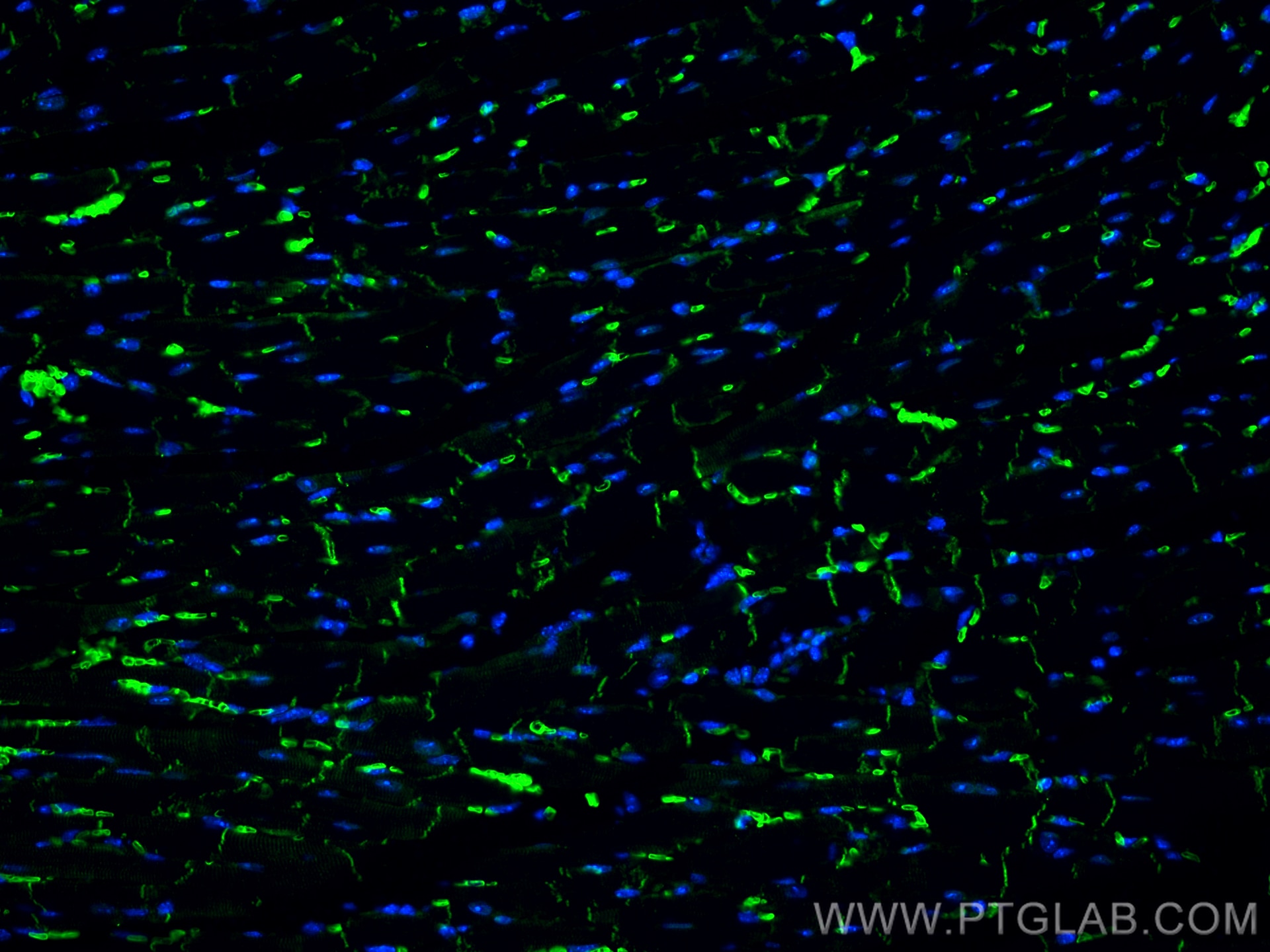 Immunofluorescence (IF) / fluorescent staining of mouse heart tissue using Desmocollin 2 Polyclonal antibody (13876-1-AP)