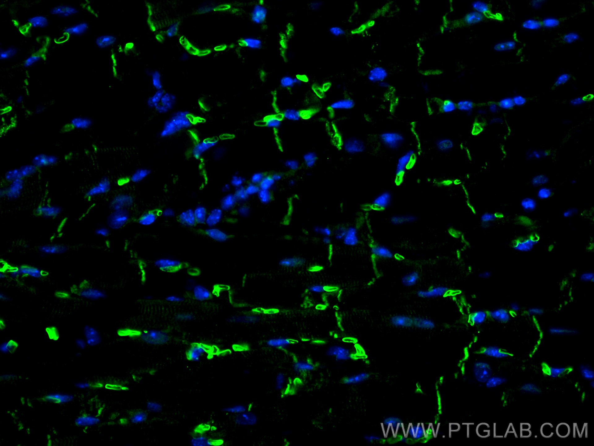 Immunofluorescence (IF) / fluorescent staining of mouse heart tissue using Desmocollin 2 Polyclonal antibody (13876-1-AP)