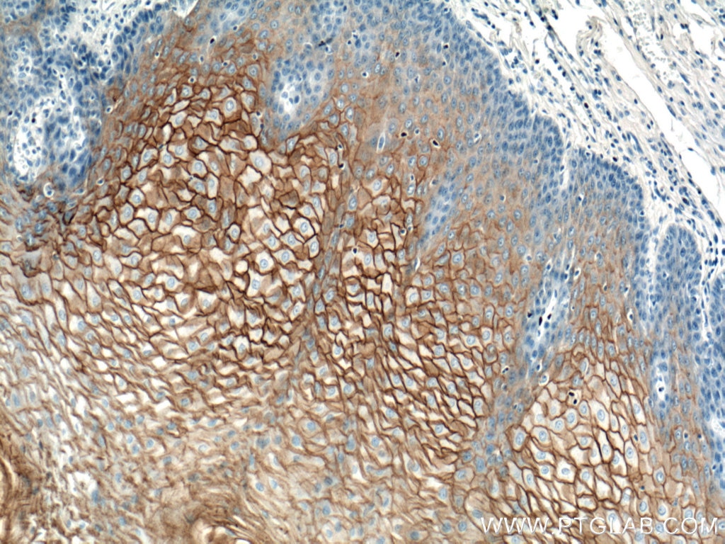 Immunohistochemistry (IHC) staining of human oesophagus tissue using Desmocollin 2 Polyclonal antibody (13876-1-AP)