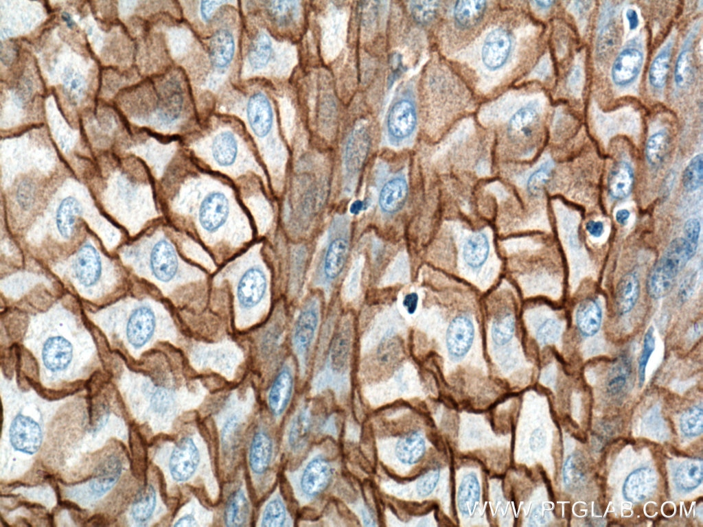 Immunohistochemistry (IHC) staining of human oesophagus tissue using Desmocollin 2 Polyclonal antibody (13876-1-AP)