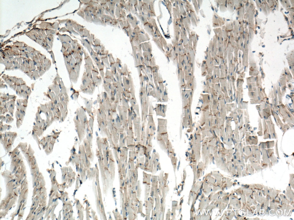 Immunohistochemistry (IHC) staining of mouse heart tissue using Desmocollin 2 Polyclonal antibody (13876-1-AP)