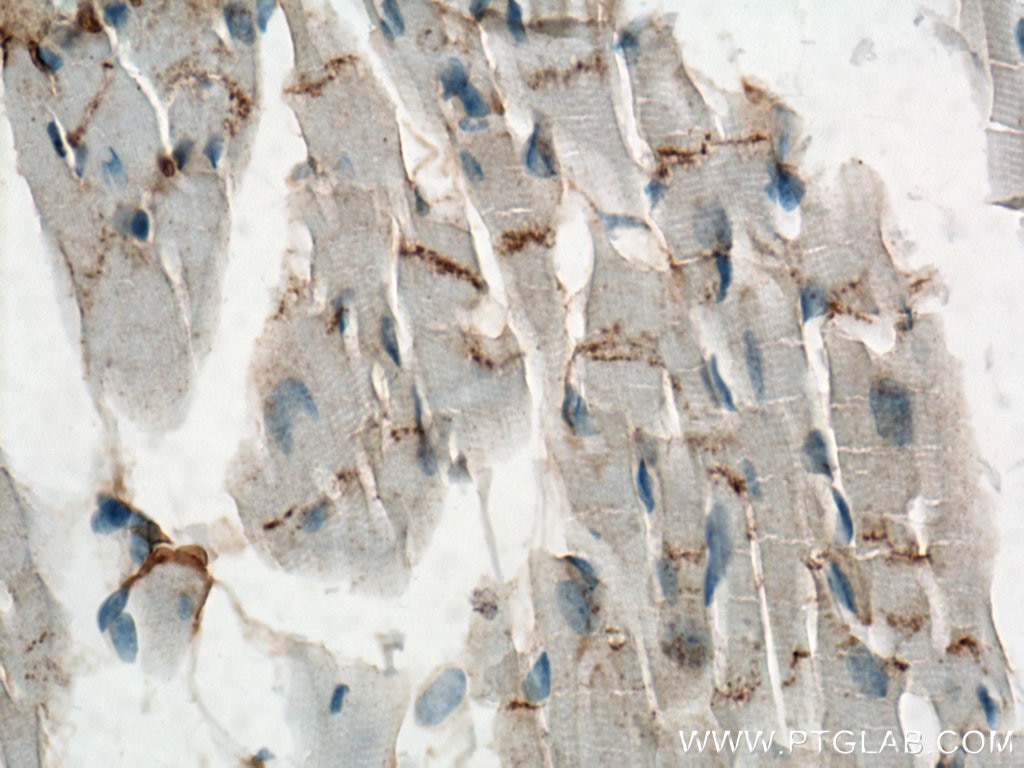 Immunohistochemistry (IHC) staining of mouse heart tissue using Desmocollin 2 Polyclonal antibody (13876-1-AP)