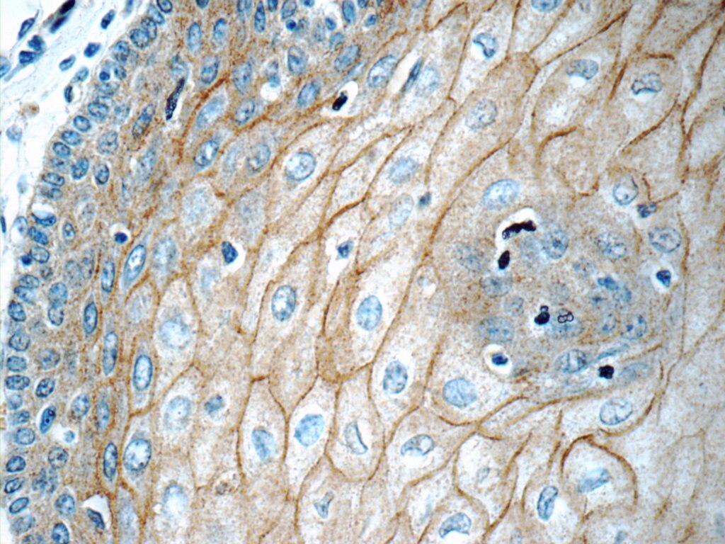 Desmocollin 2 Polyclonal antibody