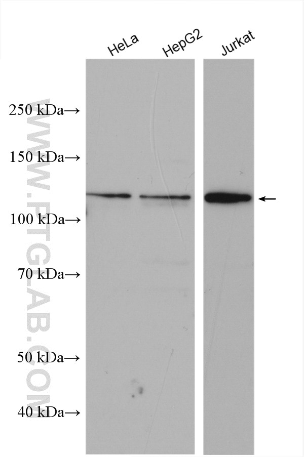 Western Blot (WB) analysis of various lysates using Desmocollin 2 Polyclonal antibody (13876-1-AP)