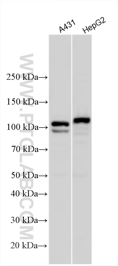Western Blot (WB) analysis of various lysates using Desmocollin 2 Polyclonal antibody (13876-1-AP)