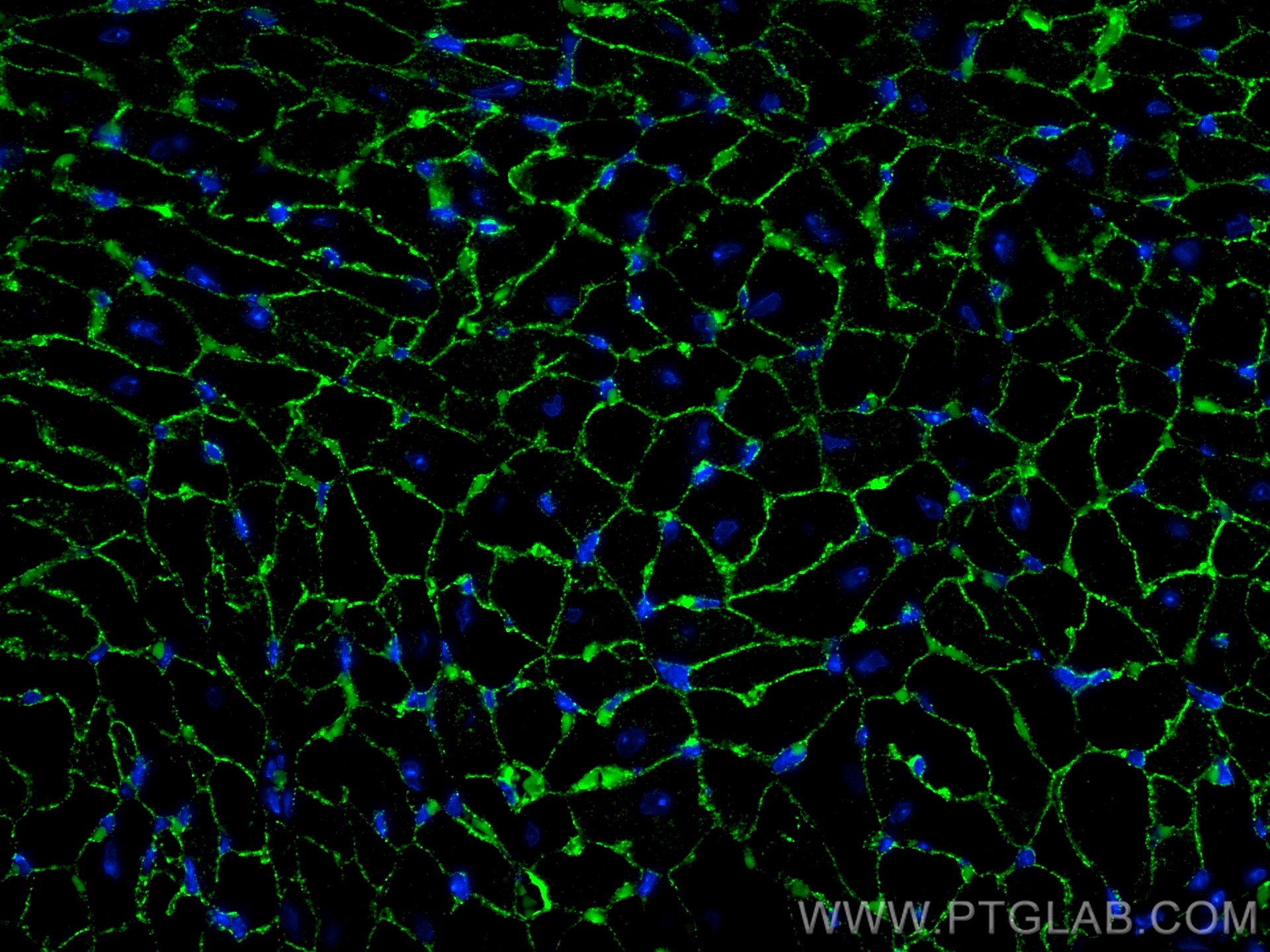 Immunofluorescence (IF) / fluorescent staining of mouse heart tissue using Desmocollin 2 Monoclonal antibody (60239-1-Ig)