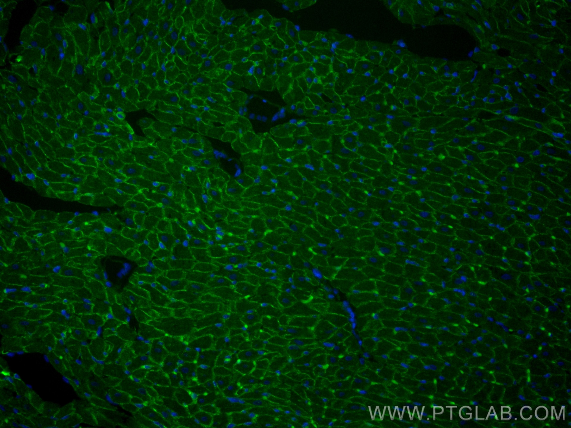 Immunofluorescence (IF) / fluorescent staining of rat heart tissue using Desmocollin 2 Monoclonal antibody (60239-1-Ig)