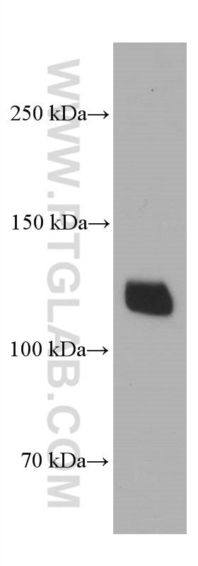 Western Blot (WB) analysis of HEK-293 cells using Desmocollin 2 Monoclonal antibody (60239-1-Ig)