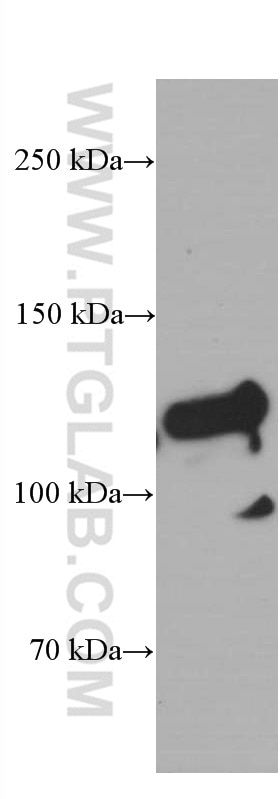 Western Blot (WB) analysis of Raji cells using Desmocollin 2 Monoclonal antibody (60239-1-Ig)