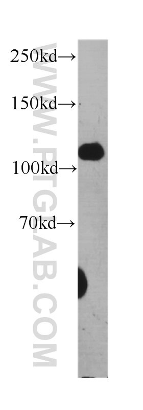 Western Blot (WB) analysis of HEK-293 cells using Desmocollin 2 Monoclonal antibody (60239-1-Ig)