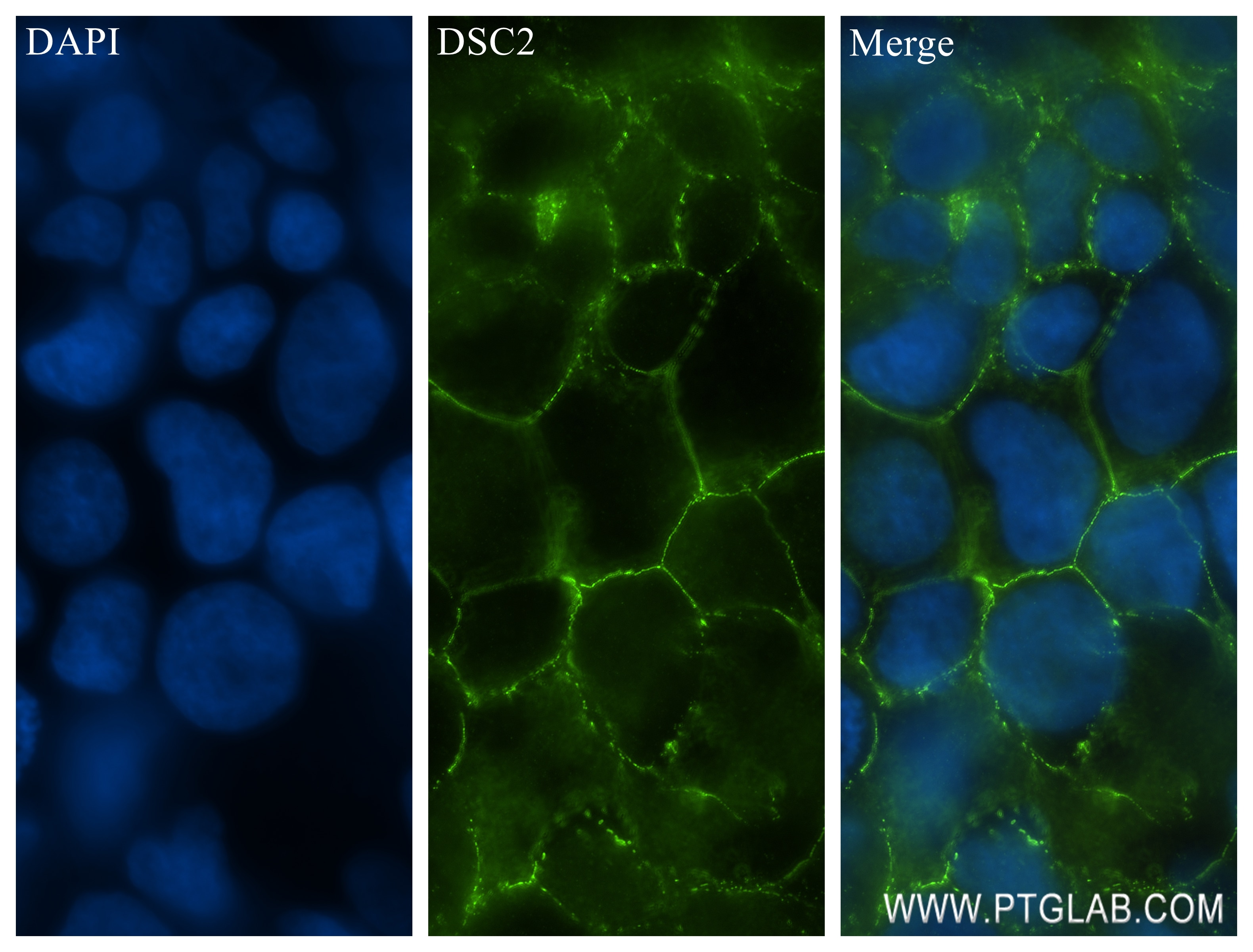 Immunofluorescence (IF) / fluorescent staining of Caco-2 cells using DSC2 Recombinant antibody (84985-1-RR)