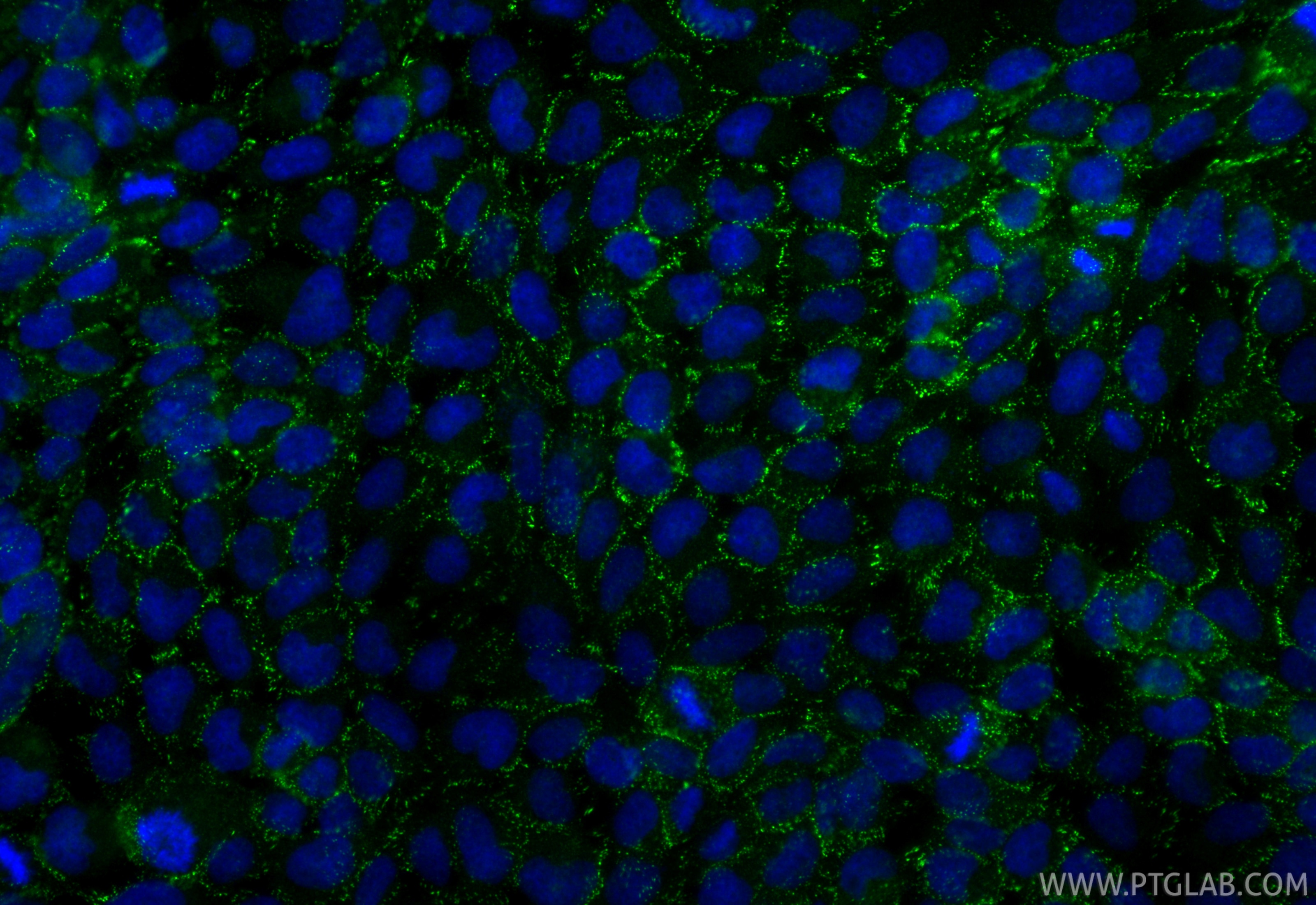 IF Staining of A431 using 84985-1-RR Immunofluorescence (IF) / fluorescent staining of A431 cells using Desmocollin 2 Recombinant monoclonal antibody (84985-1-RR)