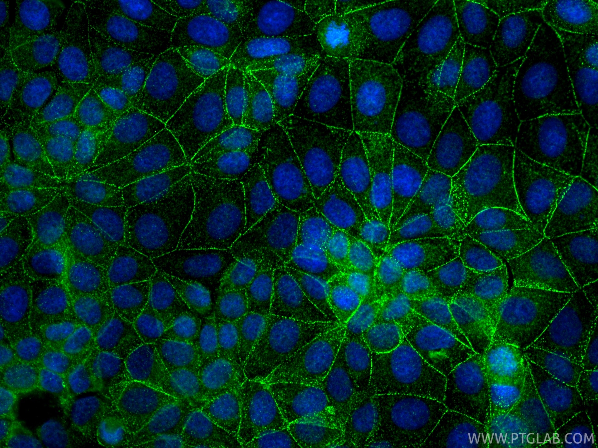 IF Staining of MCF-7 using 84985-1-RR Immunofluorescence (IF) / fluorescent staining of MCF-7 cells using Desmocollin 2 Recombinant monoclonal antibody (84985-1-RR)