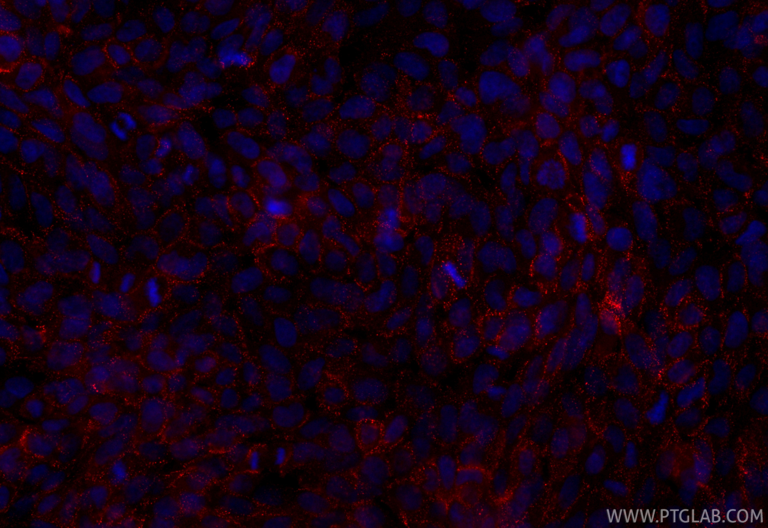 Immunofluorescence (IF) / fluorescent staining of A431 cells using CoraLite®594-conjugated DSC2 Recombinant antibody (CL594-84985)