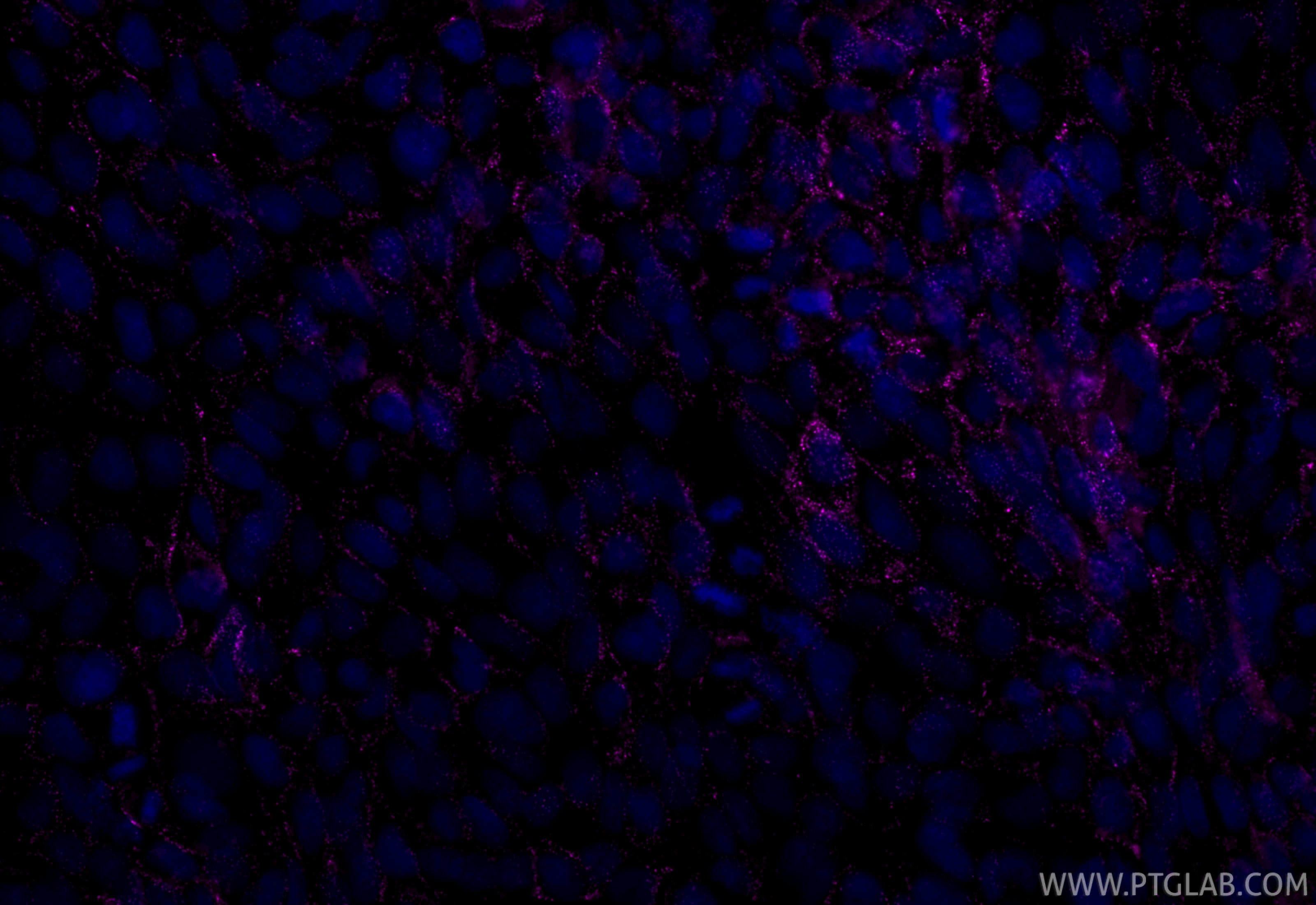 Immunofluorescence (IF) / fluorescent staining of A431 cells using CoraLite® Plus 647-conjugated DSC2 Recombinant ant (CL647-84985)