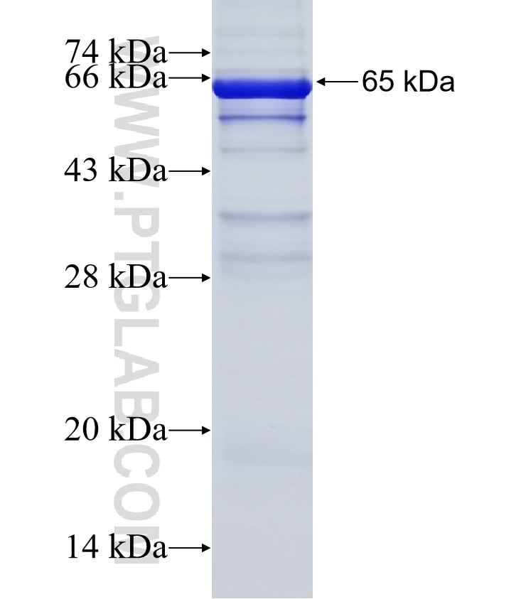 DSC2 fusion protein Ag4956 SDS-PAGE