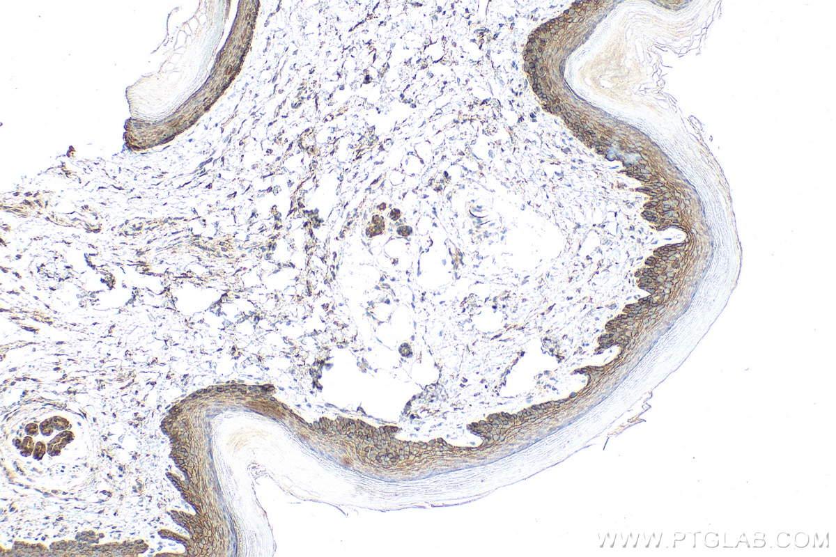 Immunohistochemistry (IHC) staining of mouse skin tissue using DSC3 Polyclonal antibody (31154-1-AP)