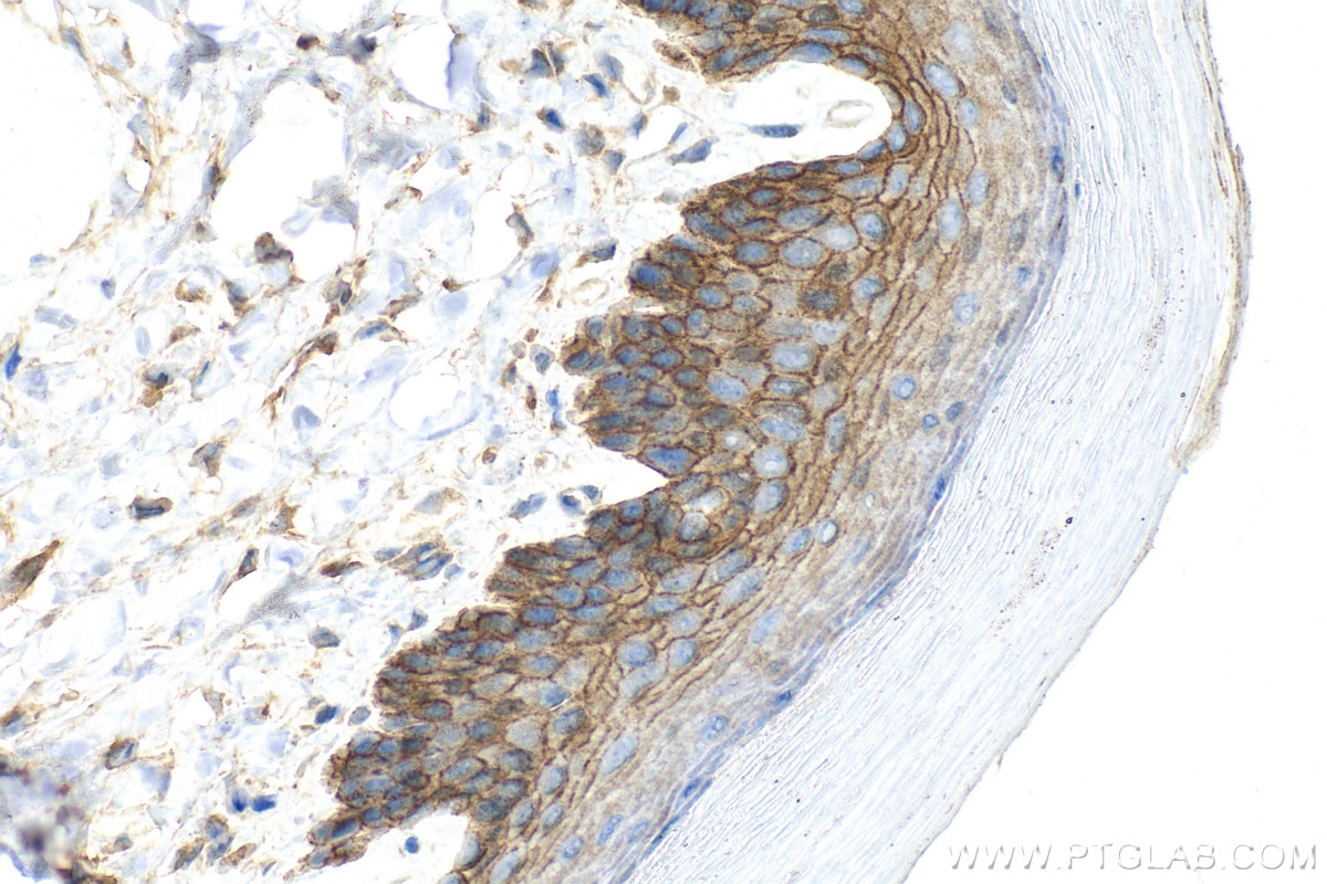 Immunohistochemistry (IHC) staining of mouse skin tissue using DSC3 Polyclonal antibody (31154-1-AP)