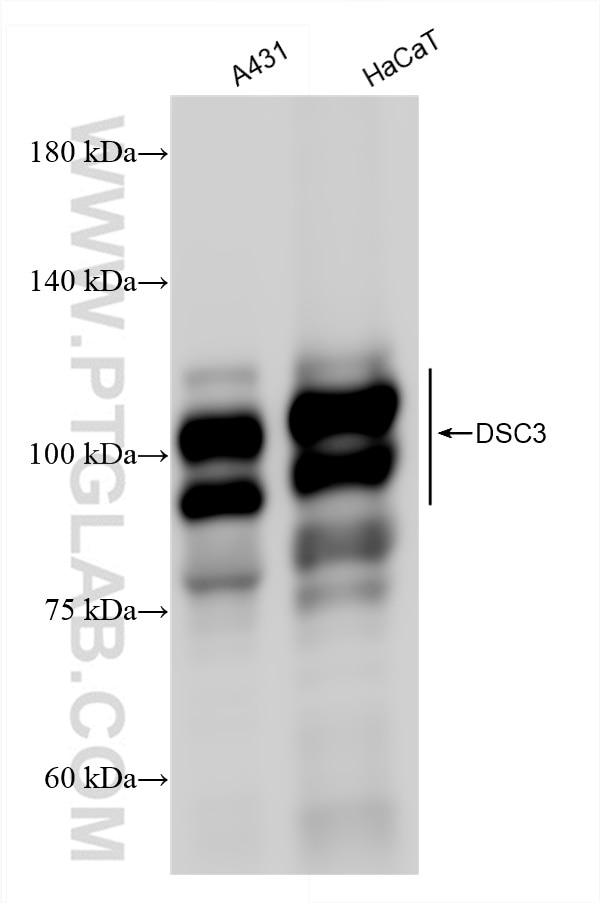 Western Blot (WB) analysis of various lysates using DSC3 Recombinant antibody (83386-5-RR)