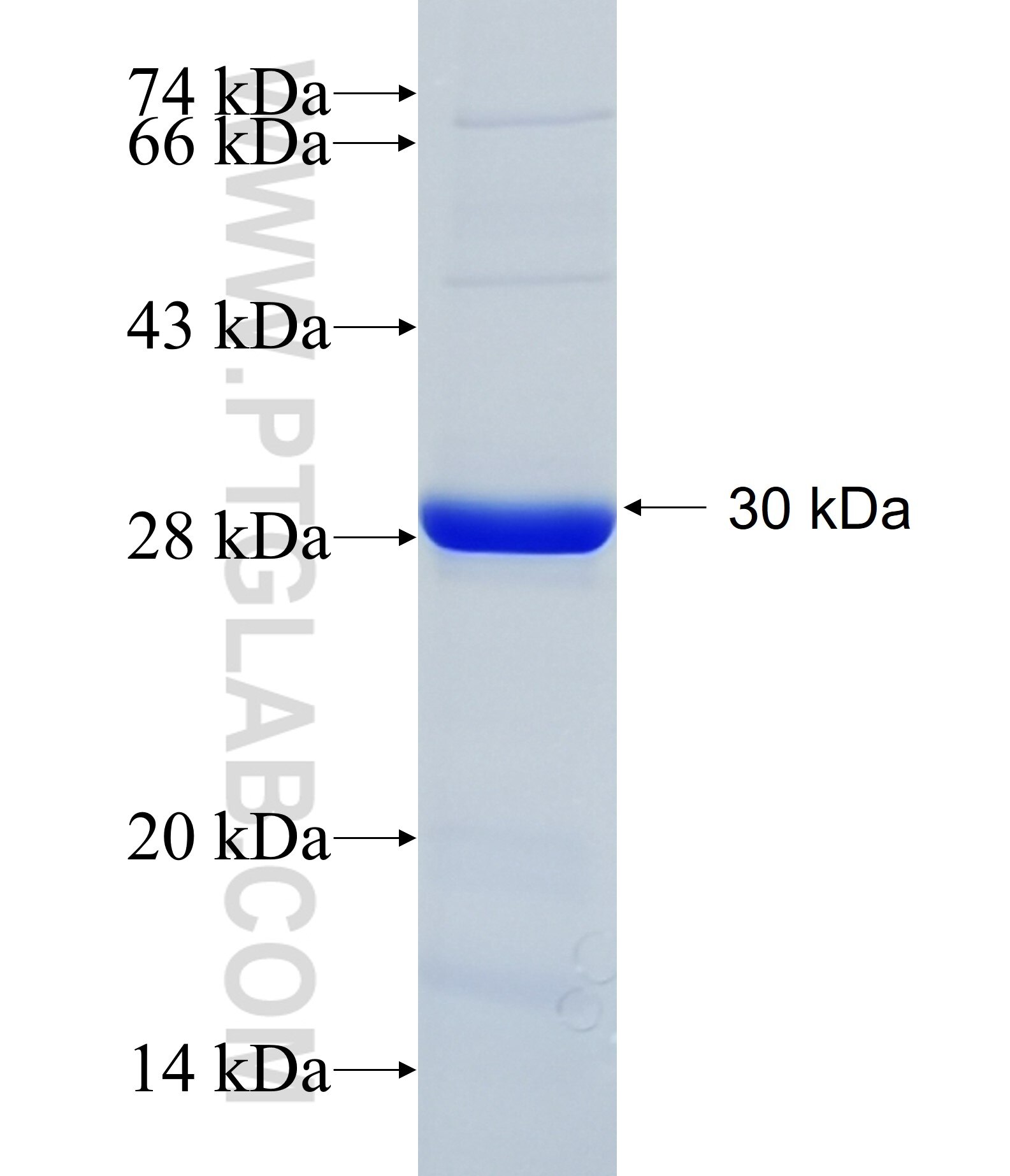 DSC3 fusion protein Ag34690 SDS-PAGE DSC3 fusion protein Ag34690 SDS-PAGE