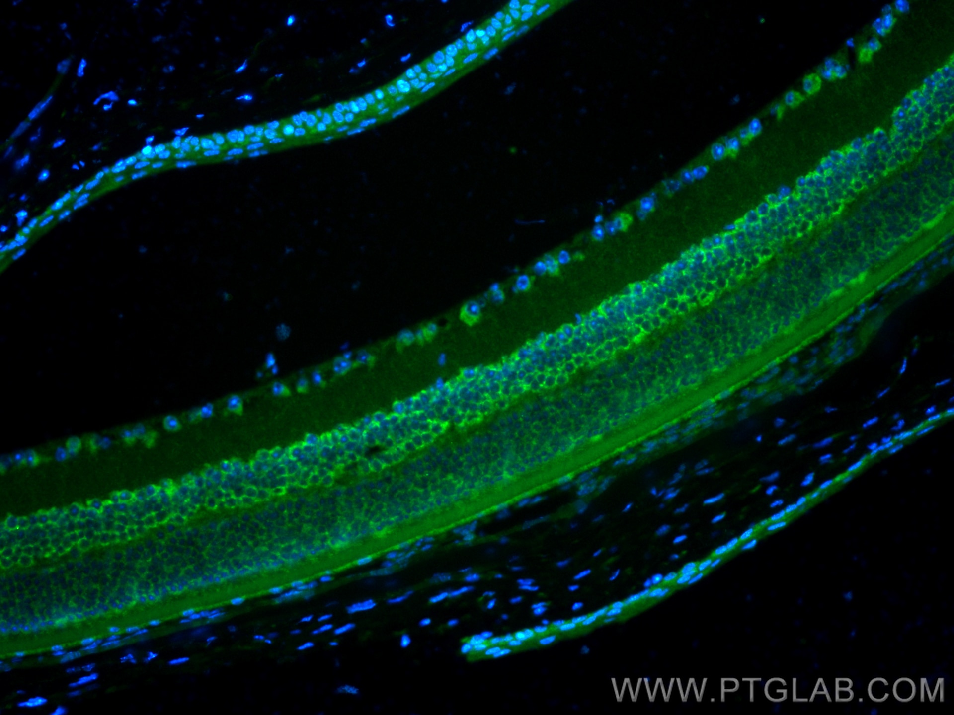 Immunofluorescence (IF) / fluorescent staining of mouse eye tissue using DSCAM Polyclonal antibody (13439-1-AP)