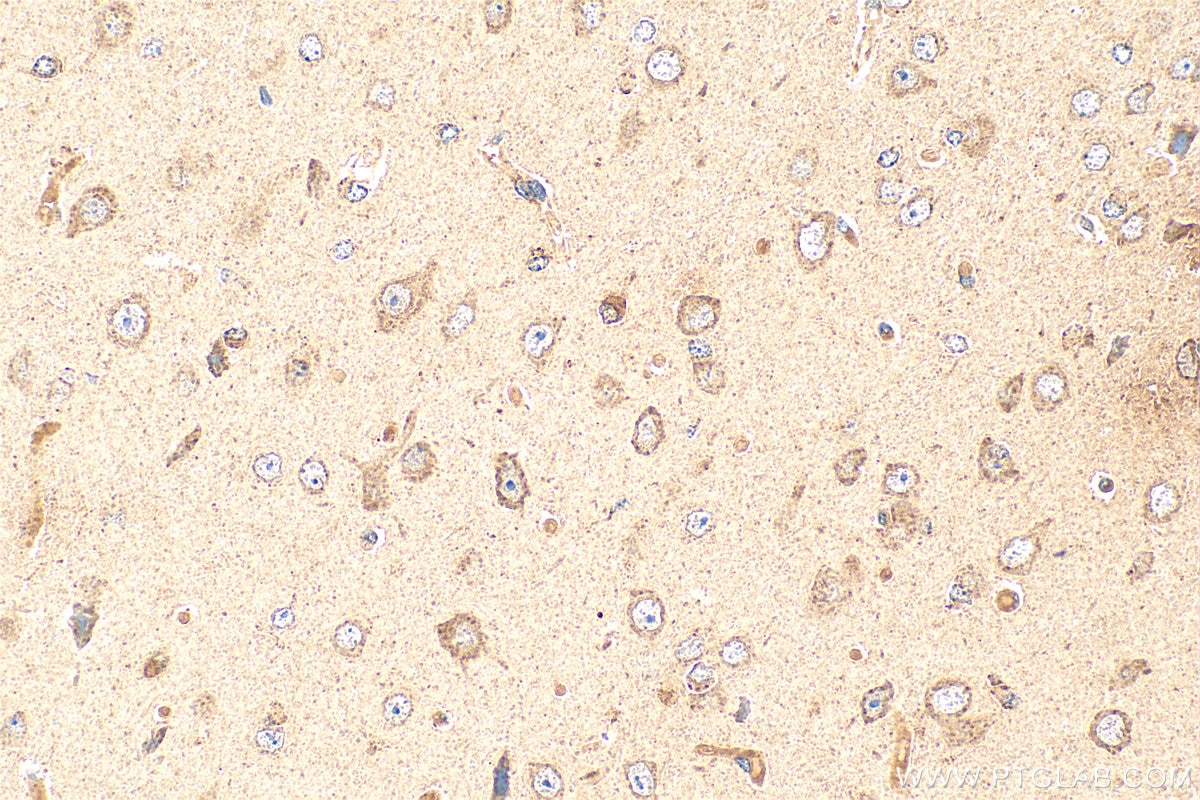 Immunohistochemistry (IHC) staining of mouse brain tissue using DSCAM Polyclonal antibody (13439-1-AP)