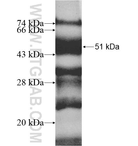 DSCC1 fusion protein Ag12943 SDS-PAGE