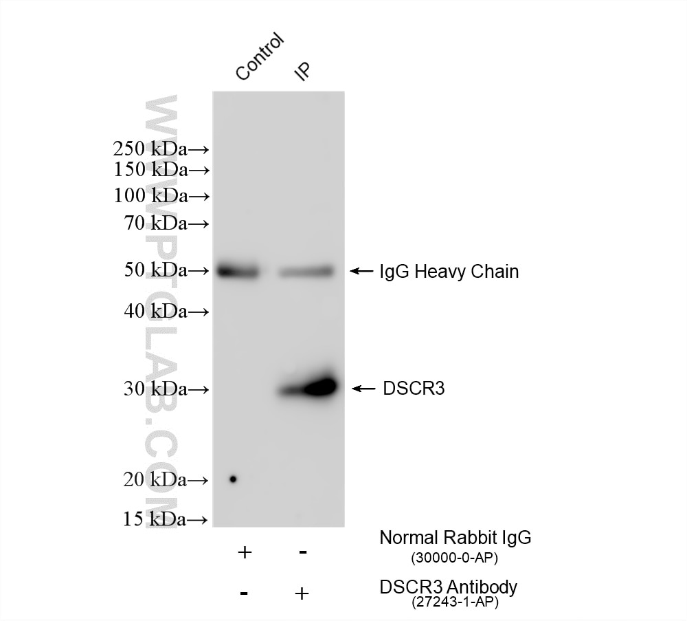 IP result of anti-DSCR3 (IP:27243-1-AP, 4ug; Detection:27243-1-AP 1:500) with SH-SY5Y cells lysate 1480 ug. Immunoprecipitation (IP) experiment of SH-SY5Y cells using DSCR3 Polyclonal antibody (27243-1-AP)