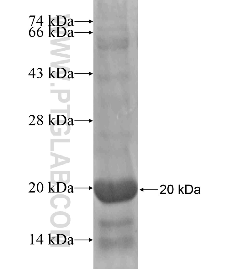 DSCR9 fusion protein Ag18364 SDS-PAGE