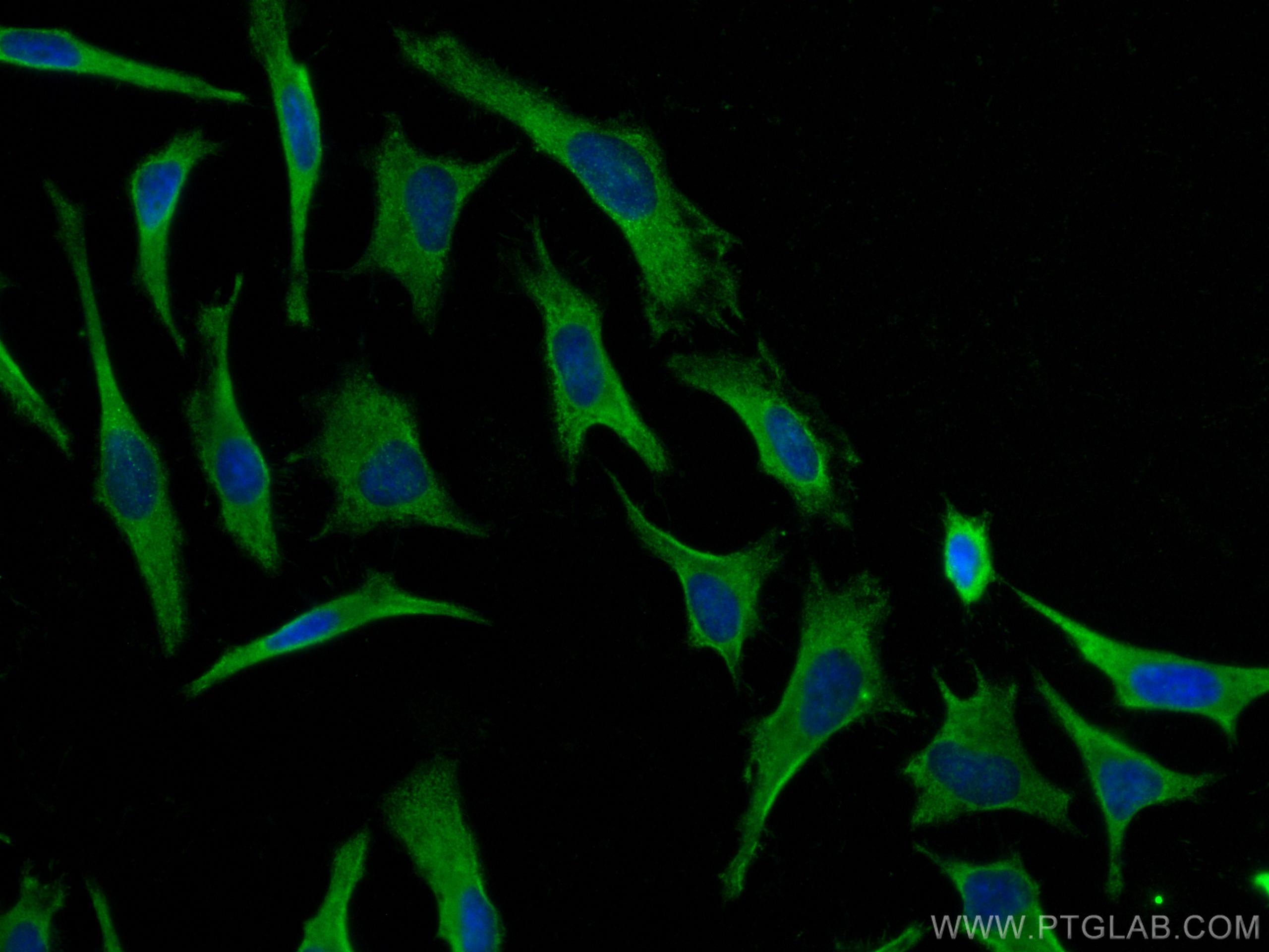 Immunofluorescence (IF) / fluorescent staining of HeLa cells using DSE Monoclonal antibody (60041-1-Ig)
