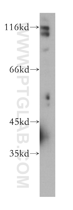 Western Blot (WB) analysis of COLO 320 cells using DSE Monoclonal antibody (60041-1-Ig)