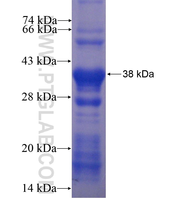 DSE fusion protein Ag16696 SDS-PAGE