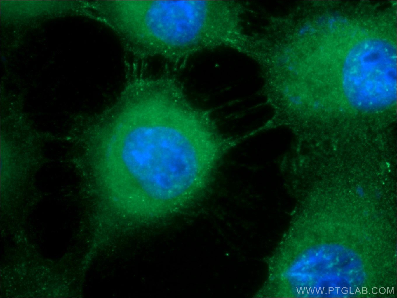 Immunofluorescence (IF) / fluorescent staining of A431 cells using DSG1 Polyclonal antibody (24587-1-AP)