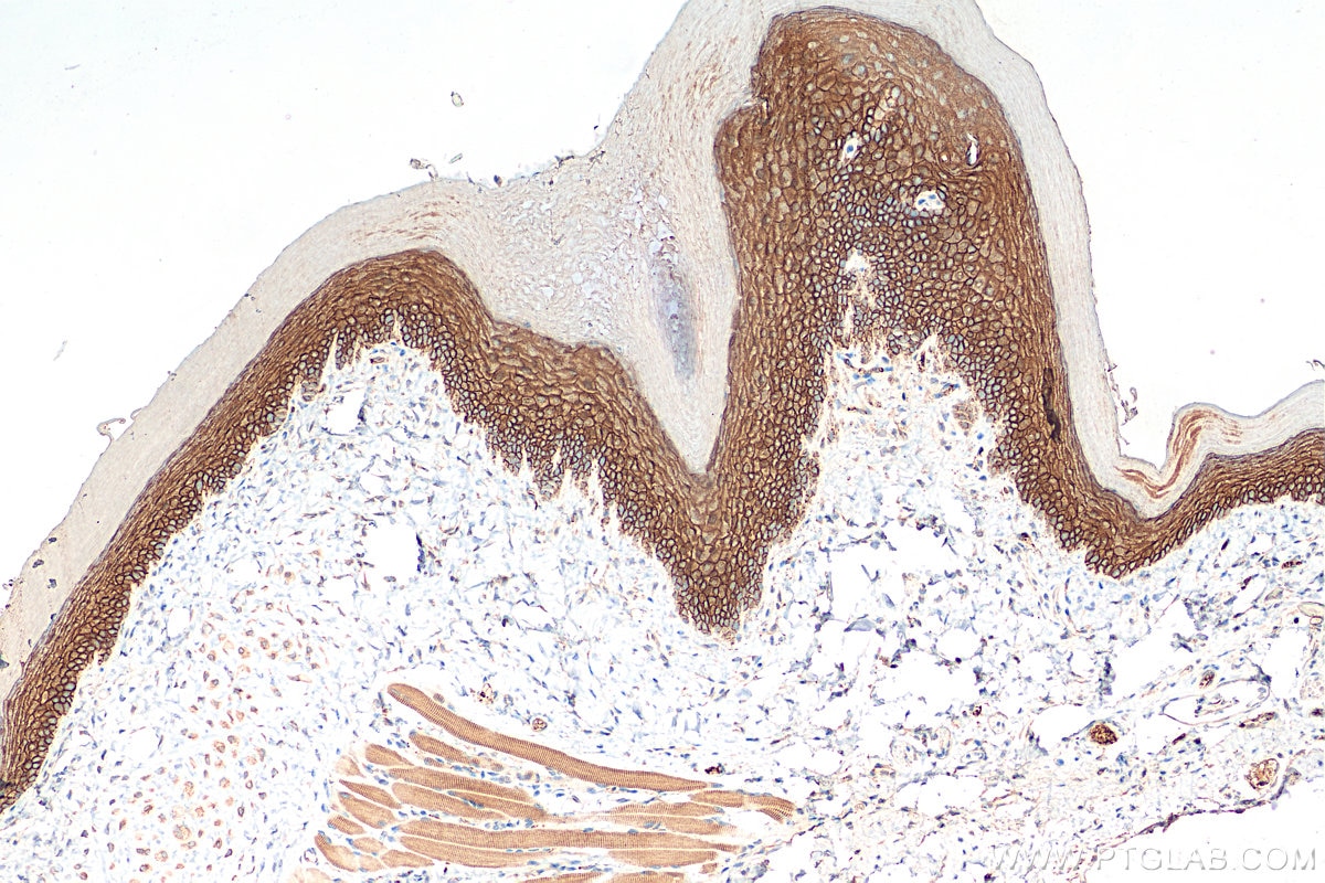 Immunohistochemistry (IHC) staining of mouse skin tissue using DSG1 Polyclonal antibody (24587-1-AP)