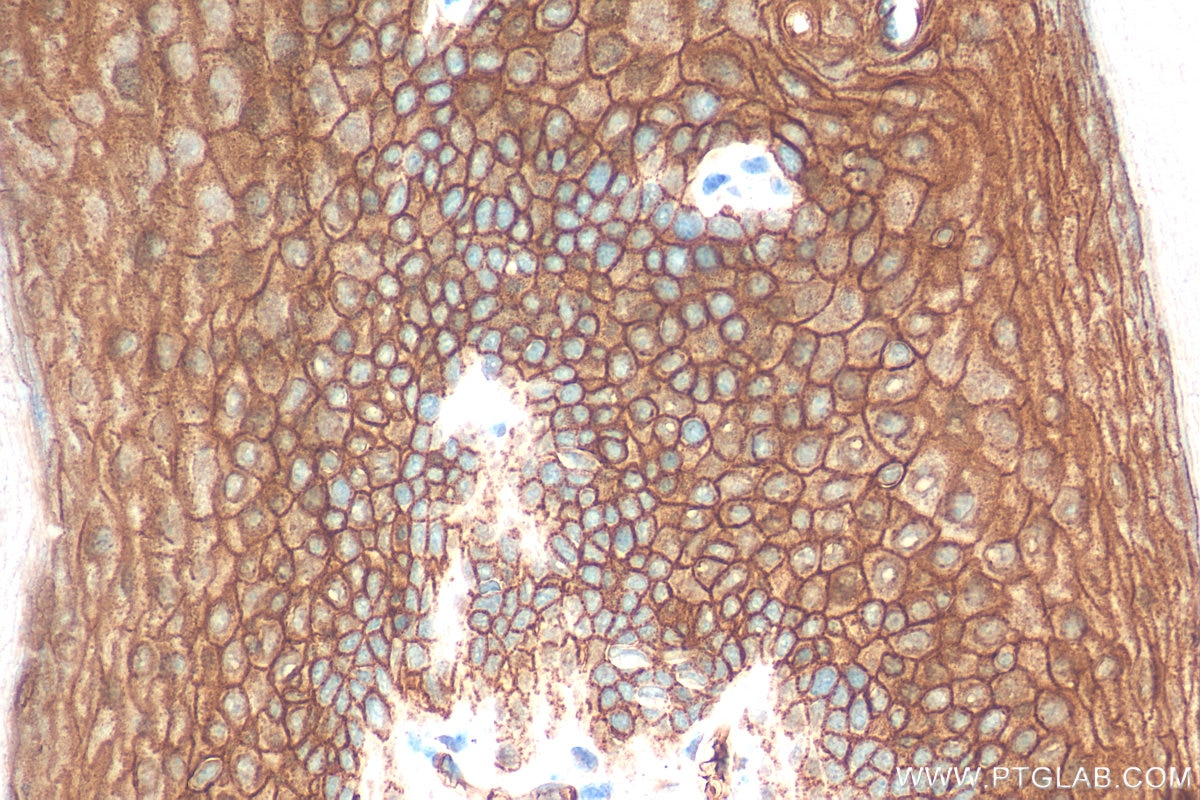 Immunohistochemistry (IHC) staining of mouse skin tissue using DSG1 Polyclonal antibody (24587-1-AP)