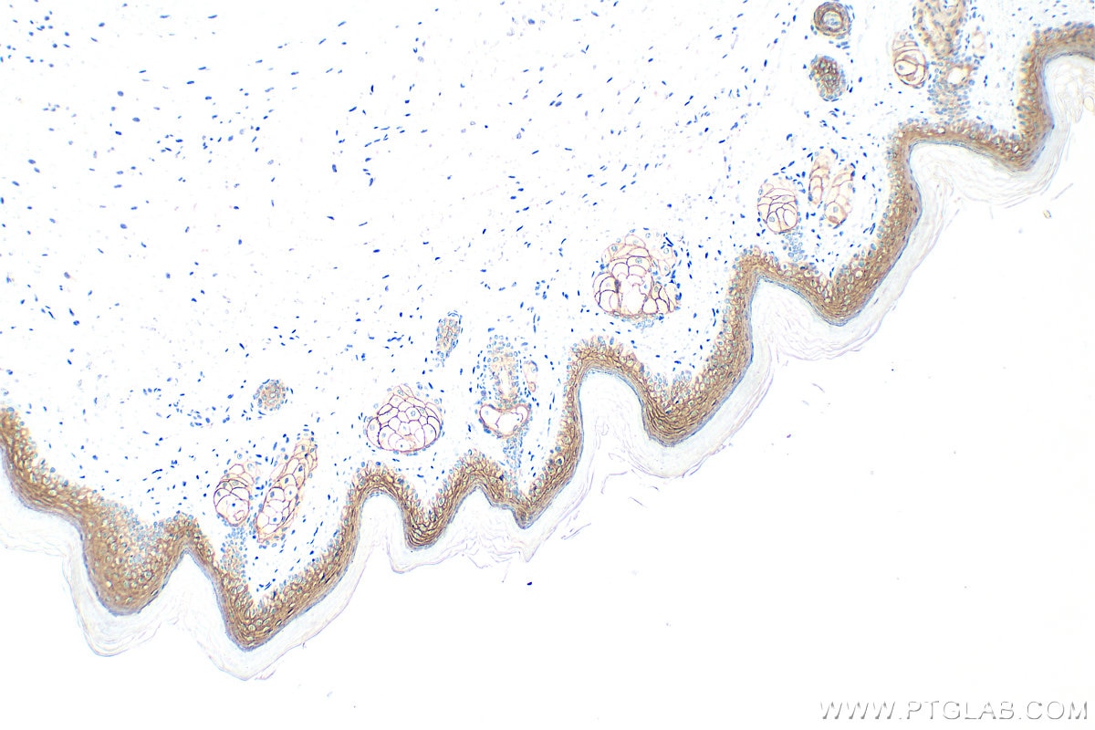 Immunohistochemistry (IHC) staining of mouse skin tissue using DSG1 Polyclonal antibody (24587-1-AP)