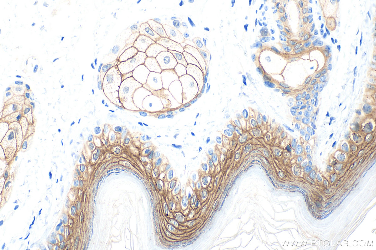 Immunohistochemistry (IHC) staining of mouse skin tissue using DSG1 Polyclonal antibody (24587-1-AP)