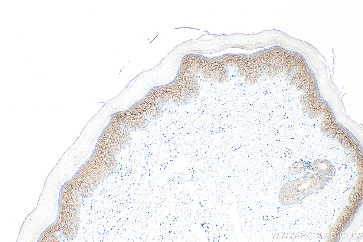 Immunohistochemistry (IHC) staining of rat skin tissue using DSG1 Polyclonal antibody (24587-1-AP)