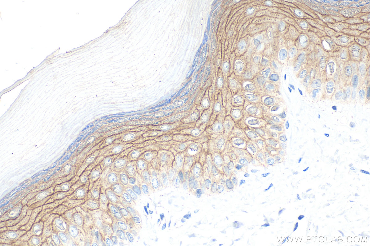 Immunohistochemistry (IHC) staining of rat skin tissue using DSG1 Polyclonal antibody (24587-1-AP)