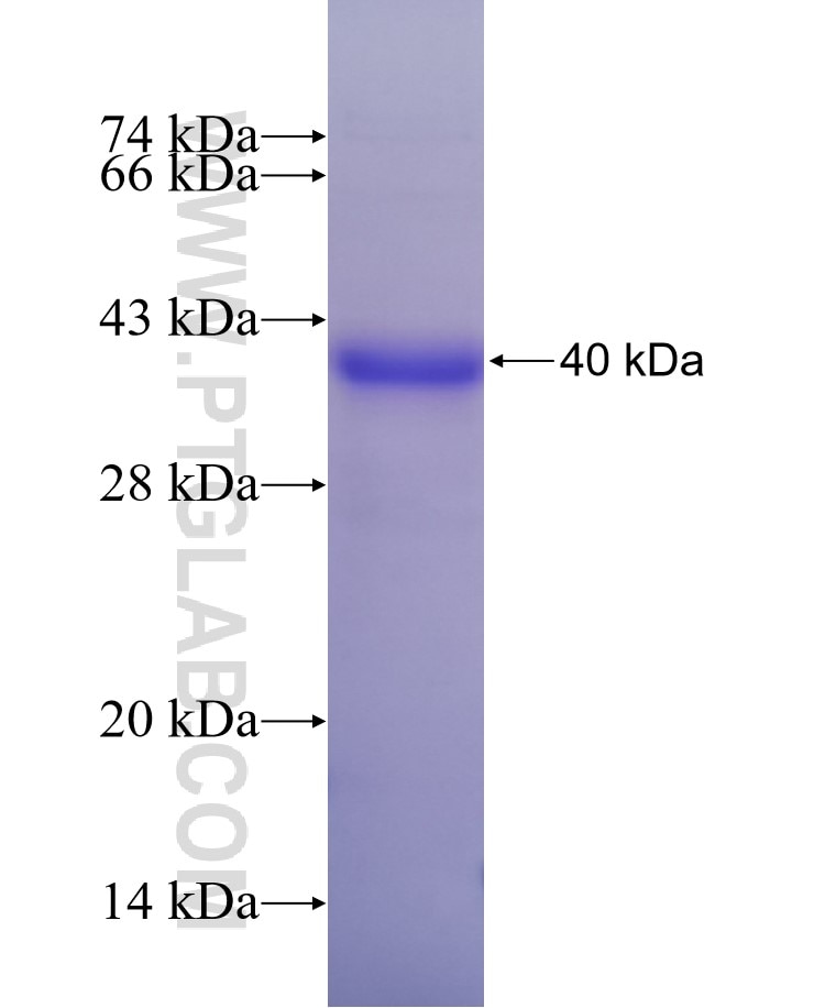 DSG1 fusion protein Ag20224 SDS-PAGE