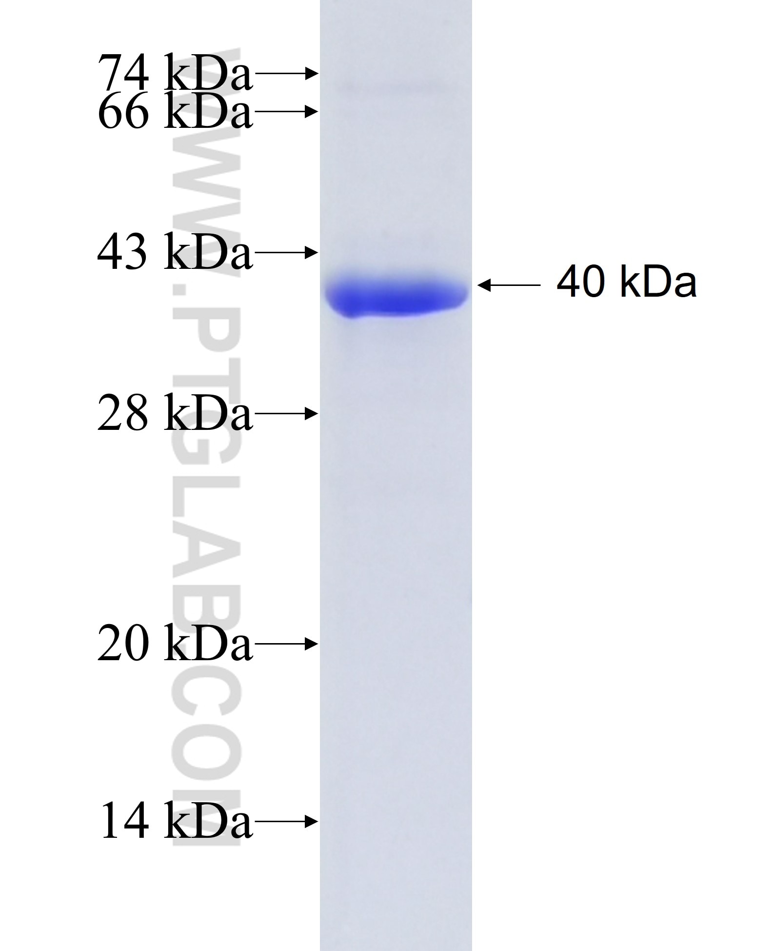 DSG1 fusion protein Ag20224 SDS-PAGE