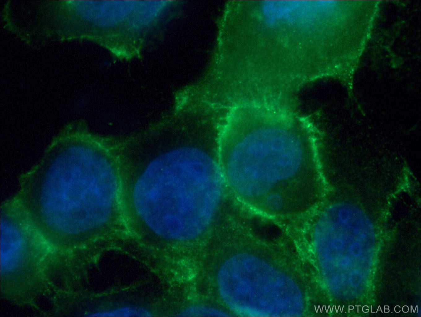 IF Staining of A431 using 21880-1-AP