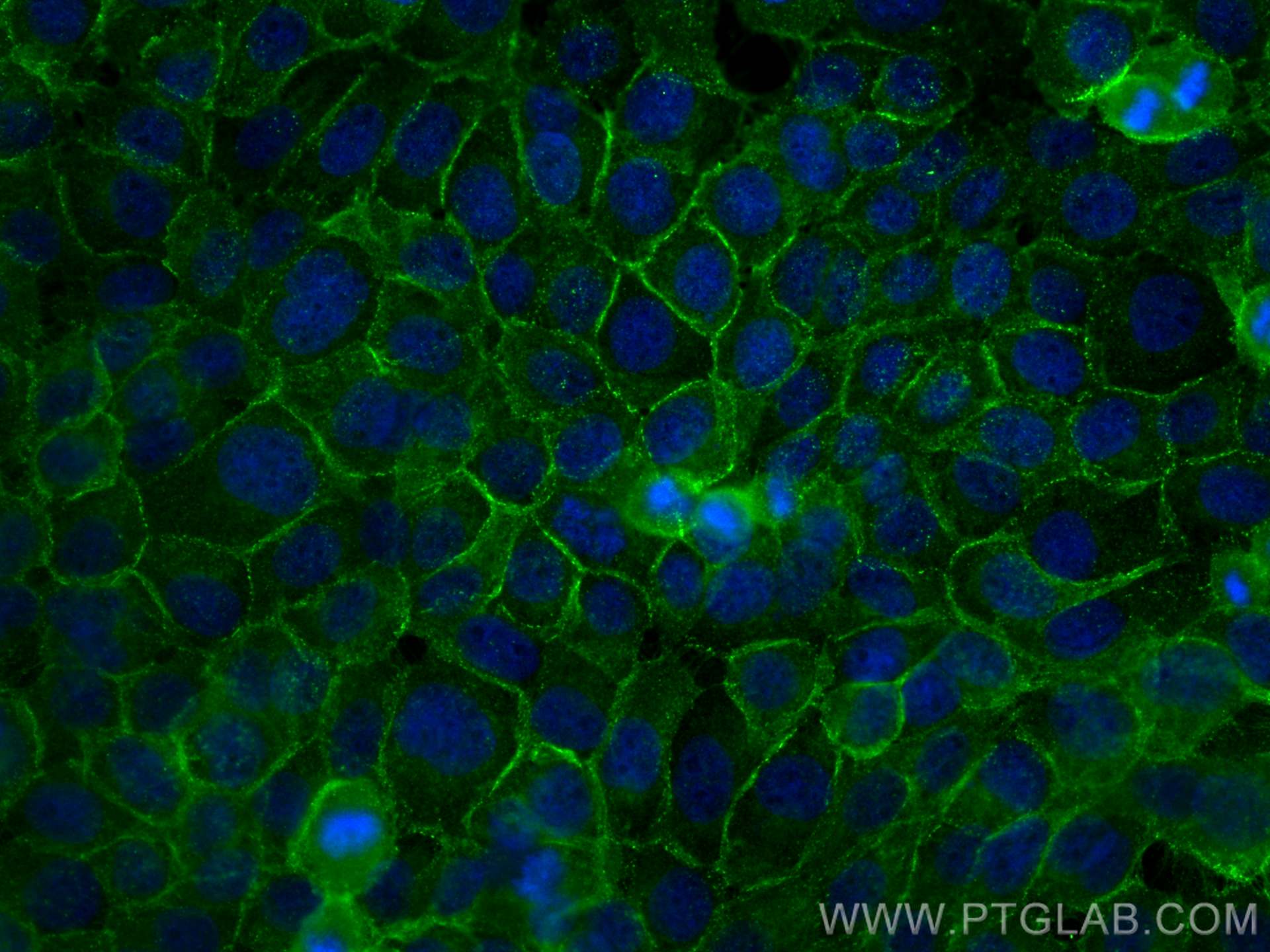 Immunofluorescence (IF) / fluorescent staining of A431 cells using DSG2 Polyclonal antibody (21880-1-AP)