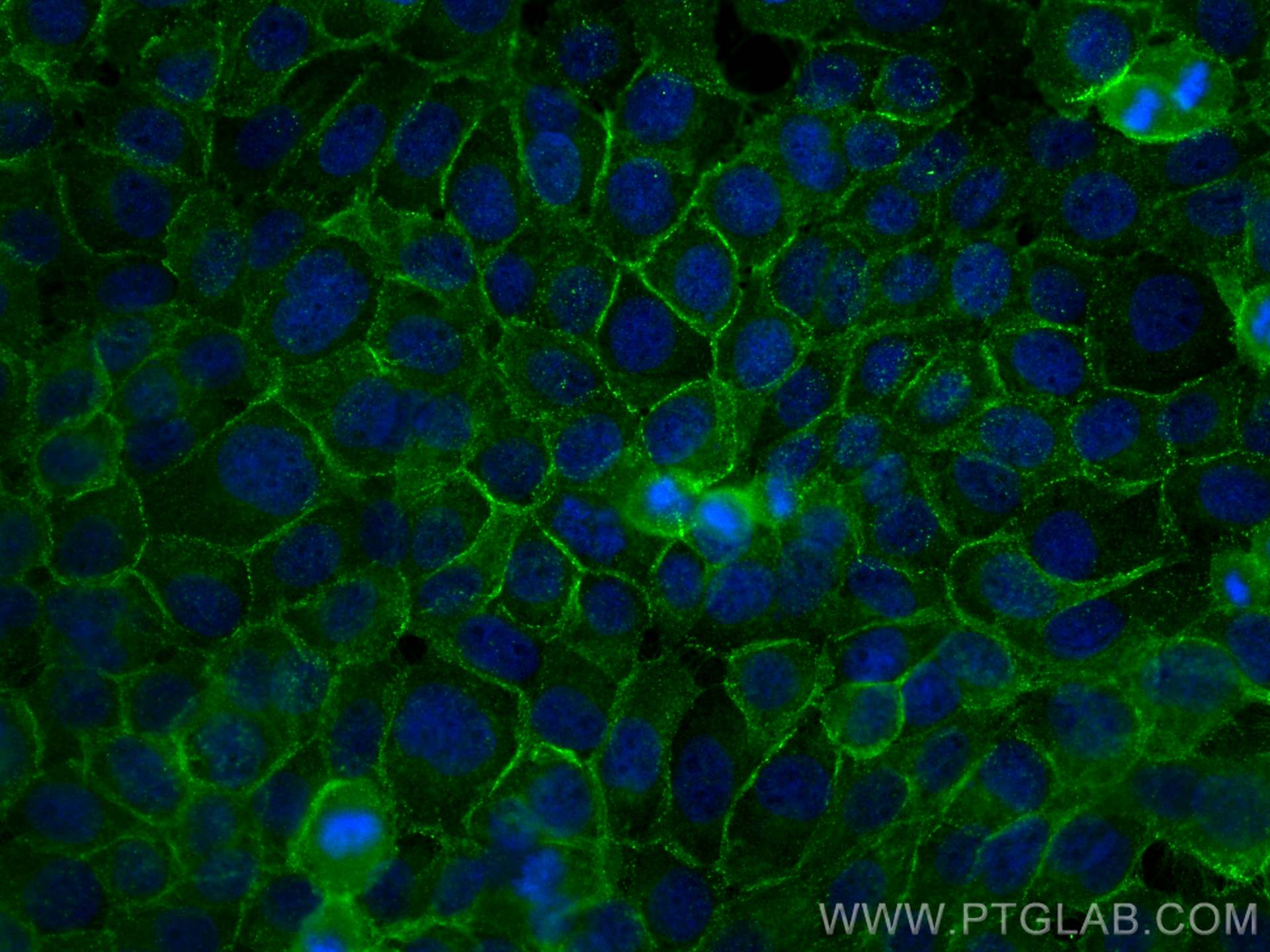 IF Staining of A431 using 21880-1-AP