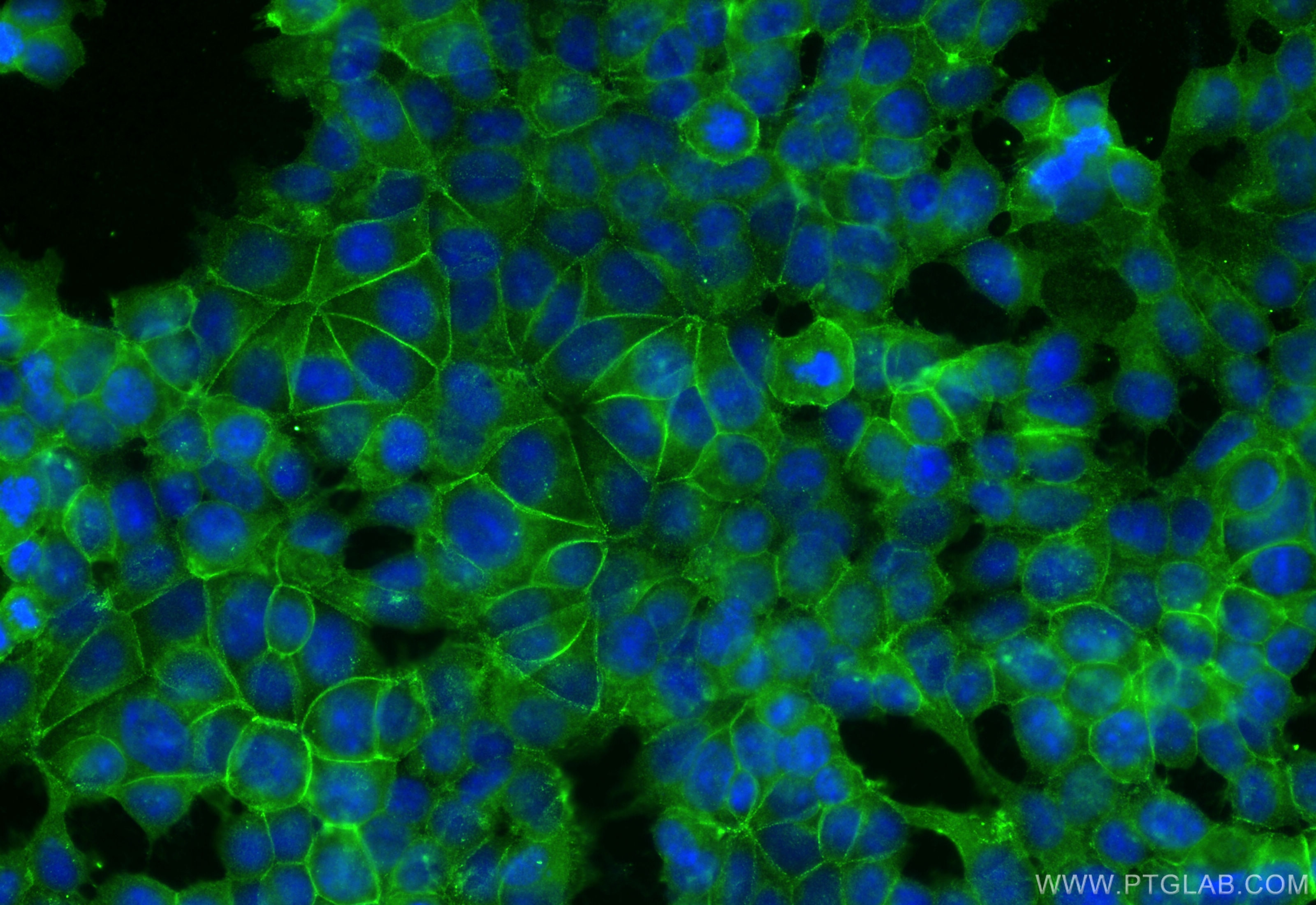 Immunofluorescence (IF) / fluorescent staining of MCF-7 cells using DSG2 Polyclonal antibody (21880-1-AP)