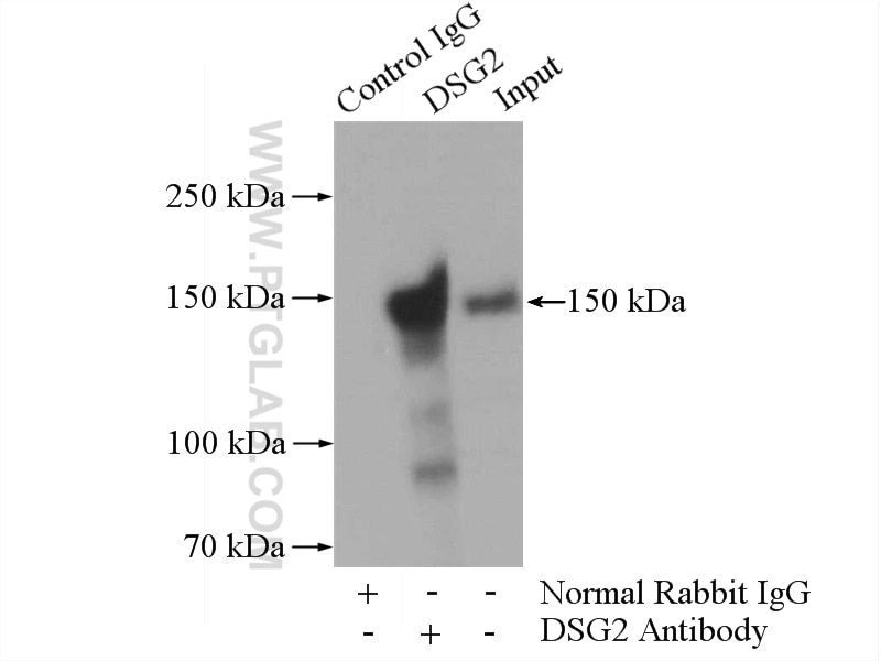 Immunoprecipitation (IP) experiment of HepG2 cells using DSG2 Polyclonal antibody (21880-1-AP)
