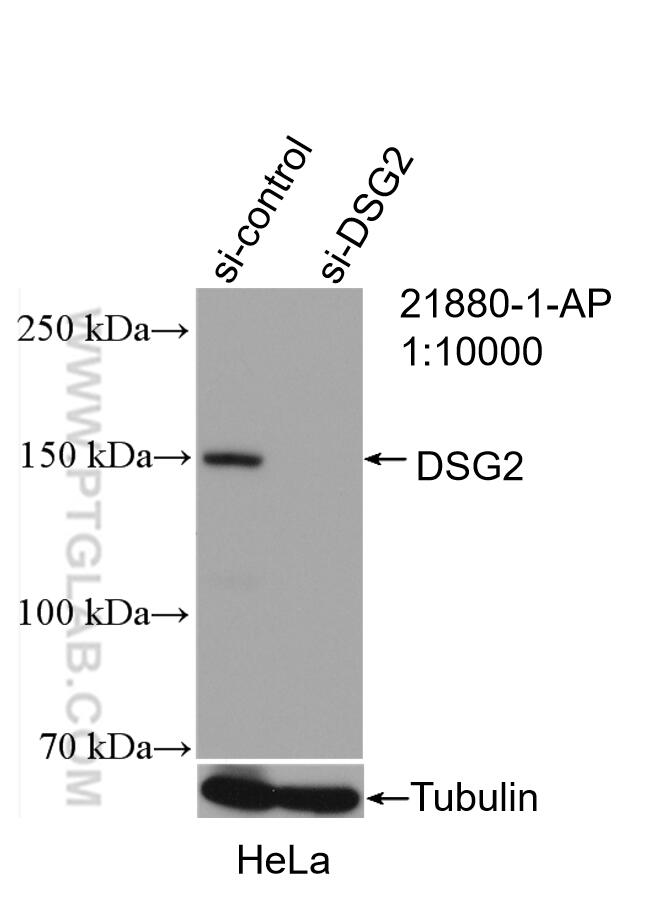 Western Blot (WB) analysis of HeLa cells using DSG2 Polyclonal antibody (21880-1-AP)
