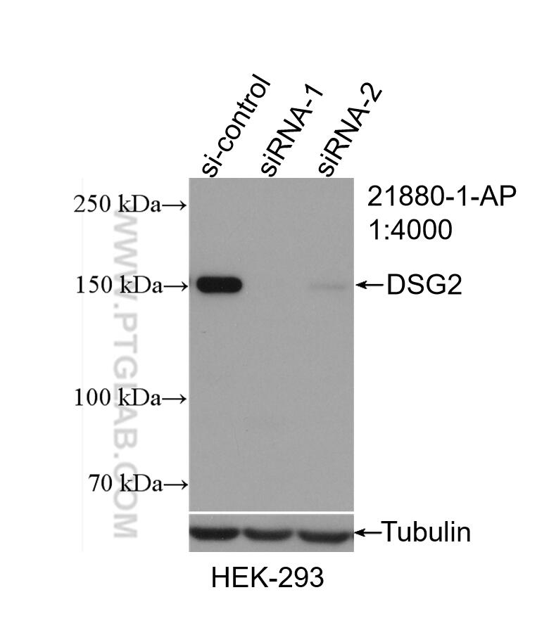 Western Blot (WB) analysis of HEK-293 cells using DSG2 Polyclonal antibody (21880-1-AP)